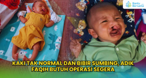 Kaki Tak Normal Dan Bibir Sumbing, Adik Faqih Butuh Operasi Segera