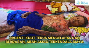 URGENT! Kulit Terus Mengelupas Dan Berdarah, Abah Amad Terkendala Biaya